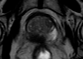 Diapositiva1-(1)