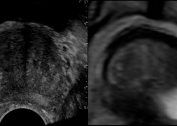 Diapositiva3